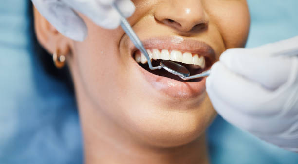 Best Emergency Wisdom Tooth Extraction in Amelia Court House, VA